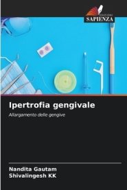 Ipertrofia Gengivale