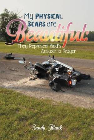 My Physical Scars Are Beautiful: They Represent God's Answer to Prayer