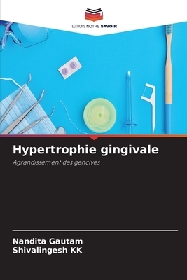 Hypertrophie Gingivale