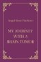 My Journey with a Brain Tumor