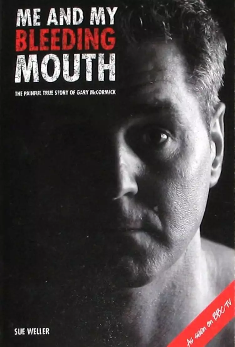 Me and My Bleeding Mouth: The Painful Story of Gary McCormick